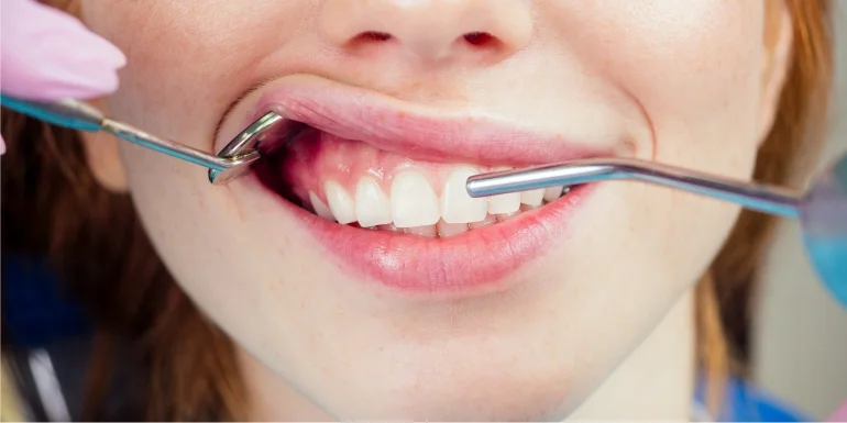 Top 7 Tips To Consider Before Going For A Dental Procedure