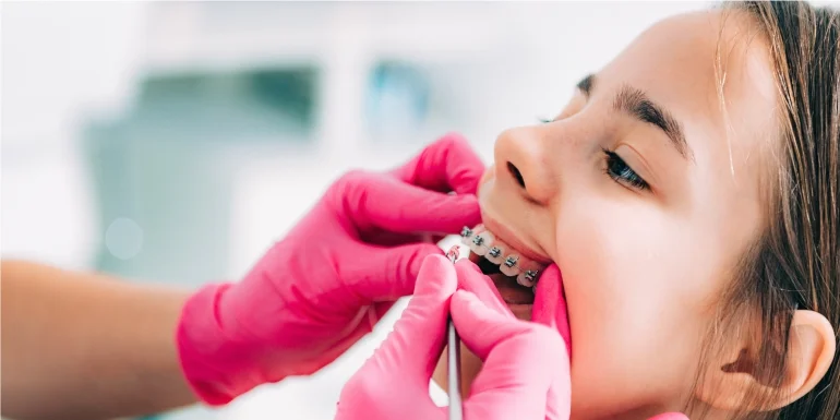 Invisalign Vs Metal Braces 1