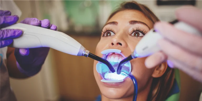 How long does Gingivoplasty last