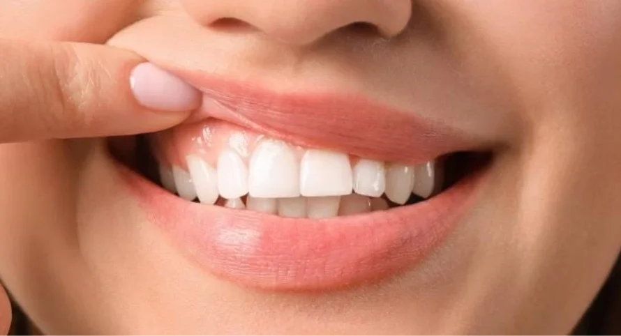 Transforming Gums