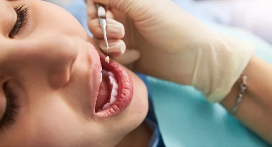 Dental Restoration.pn2