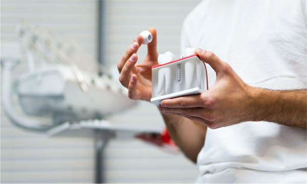 Dental Implants Main