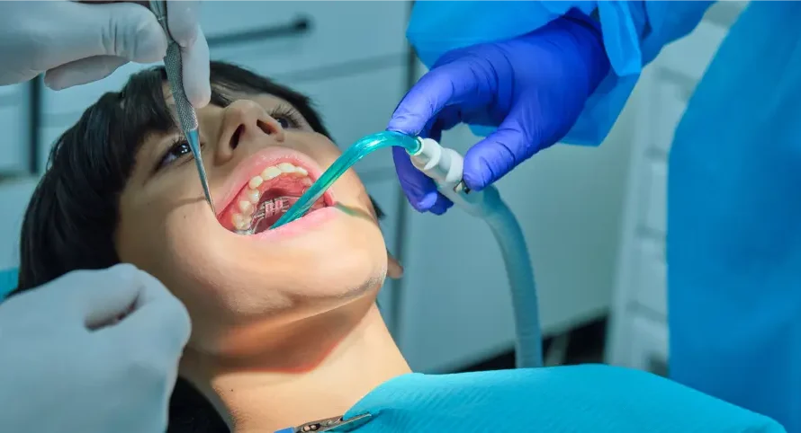 Root Canal Better Than Extraction