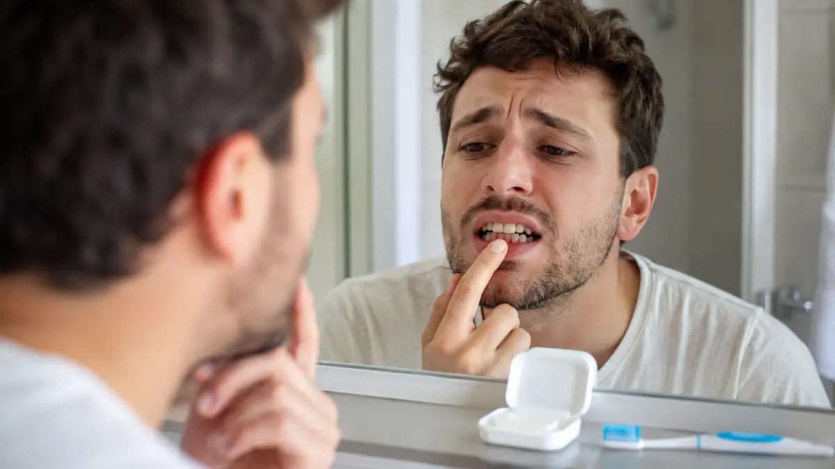 How to Fix a Chipped Tooth at Home How to Fix a Chipped Tooth at Home